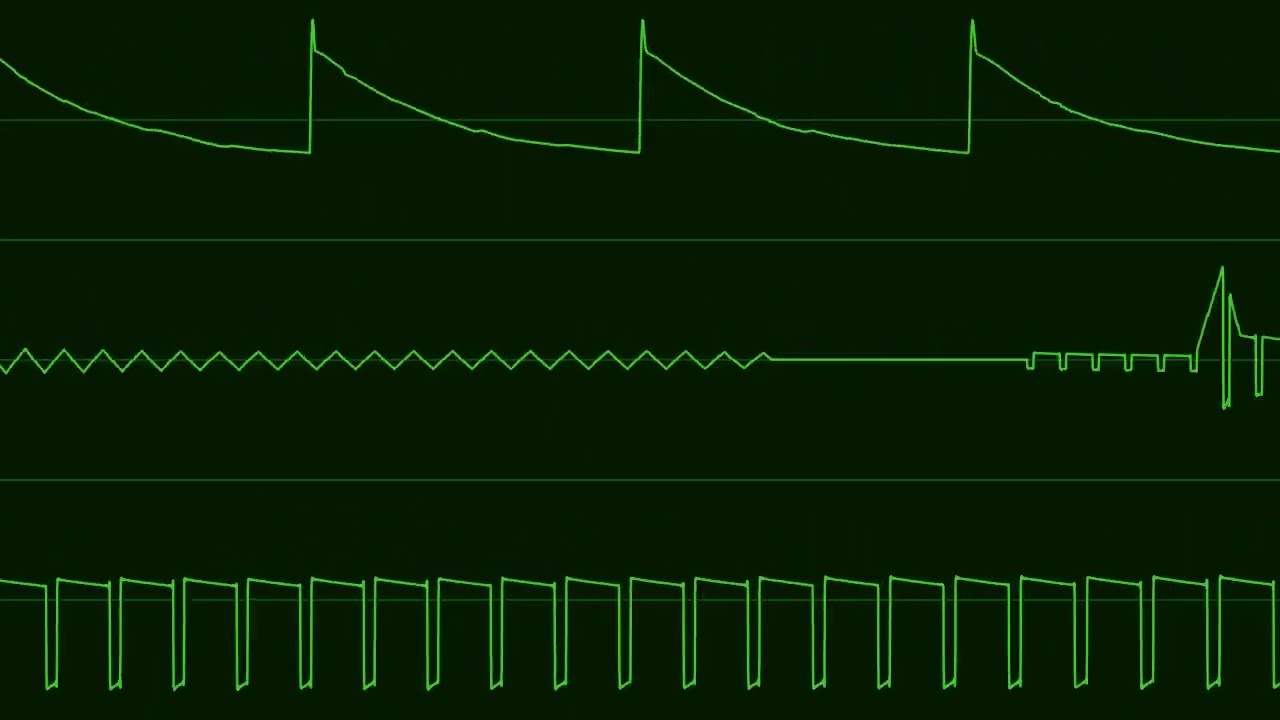 Mutetus - Peace Piece [Commodore 64 SID 6581]
