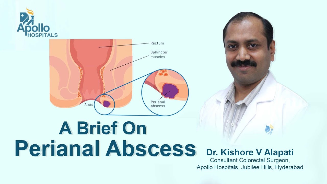 Perianal Abscess | Dr  Kishore V Alapati | Colorectal Surgeon | Apollo Hospital Hyderabad