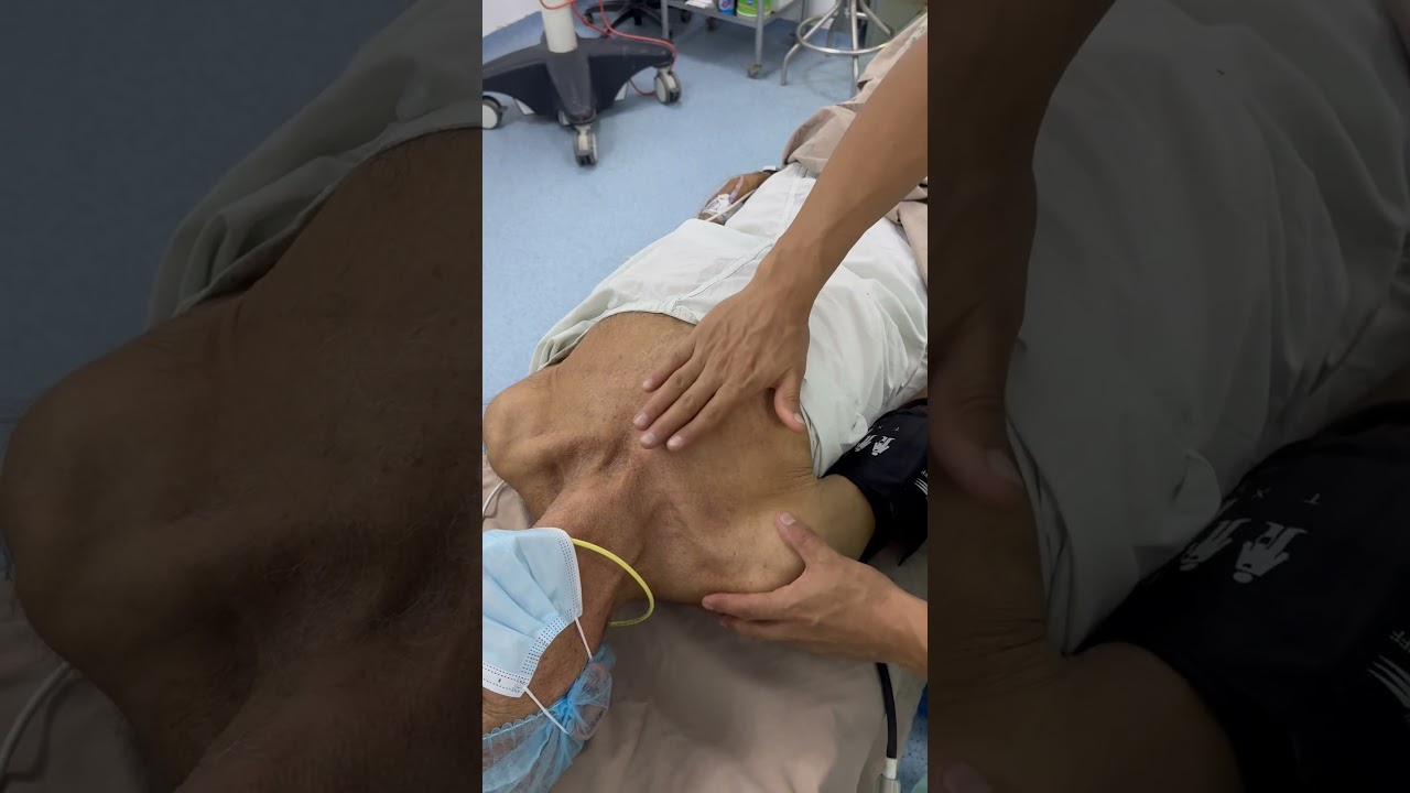 Cat&eacute;ter venoso central , punci&oacute;n subclavia : Tips