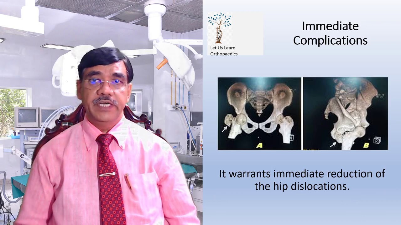 Let Us Learn Orthopedics- Anterior and Central Hip Dislocation