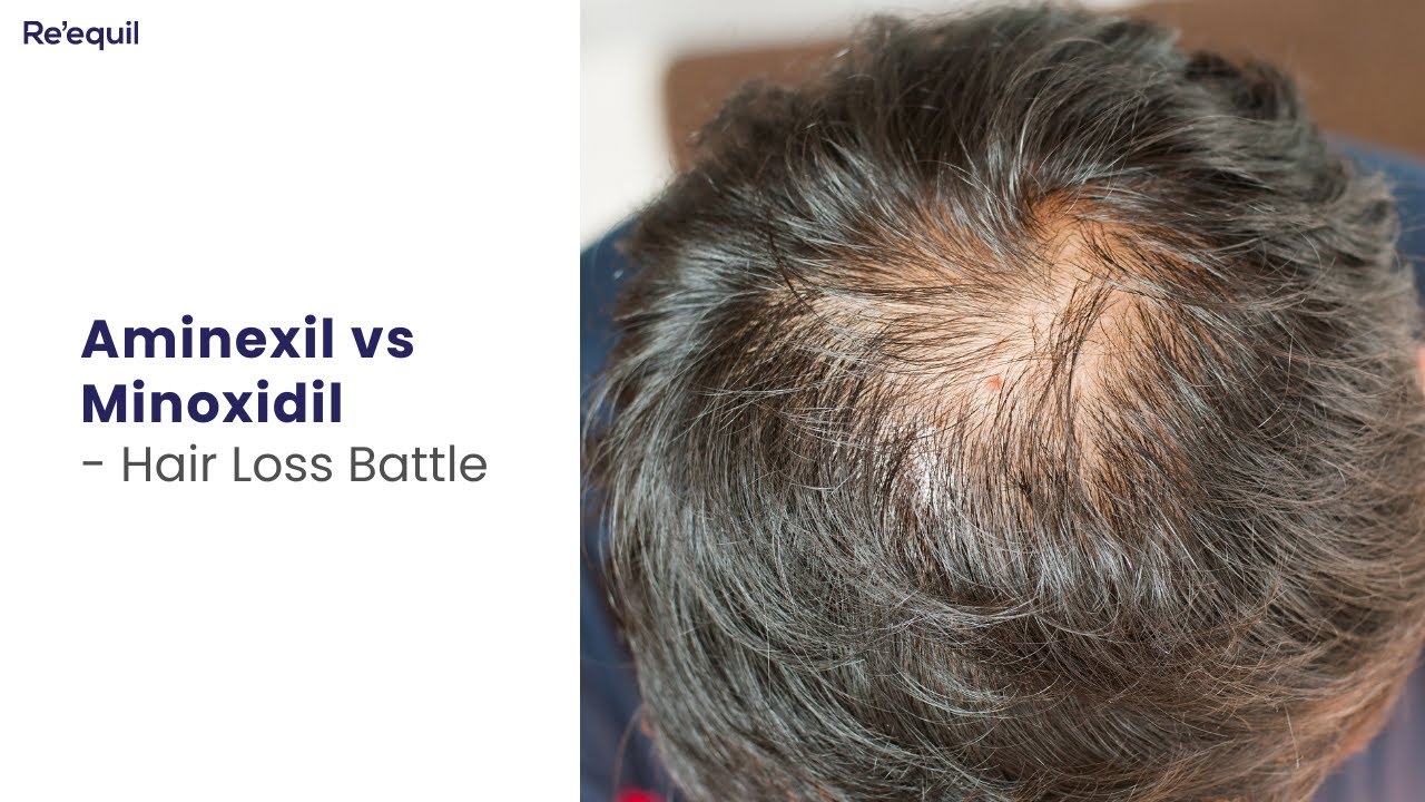 Aminexil vs Minoxidil - Hairloss Battle