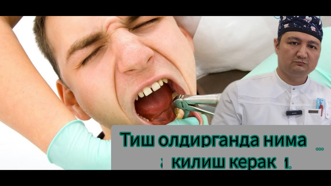 тиш олдиргандан кегинги тавсиялар.