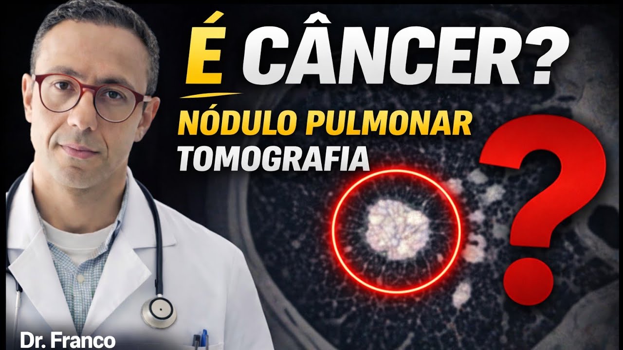 Nódulo Pulmonar - tudo sobre