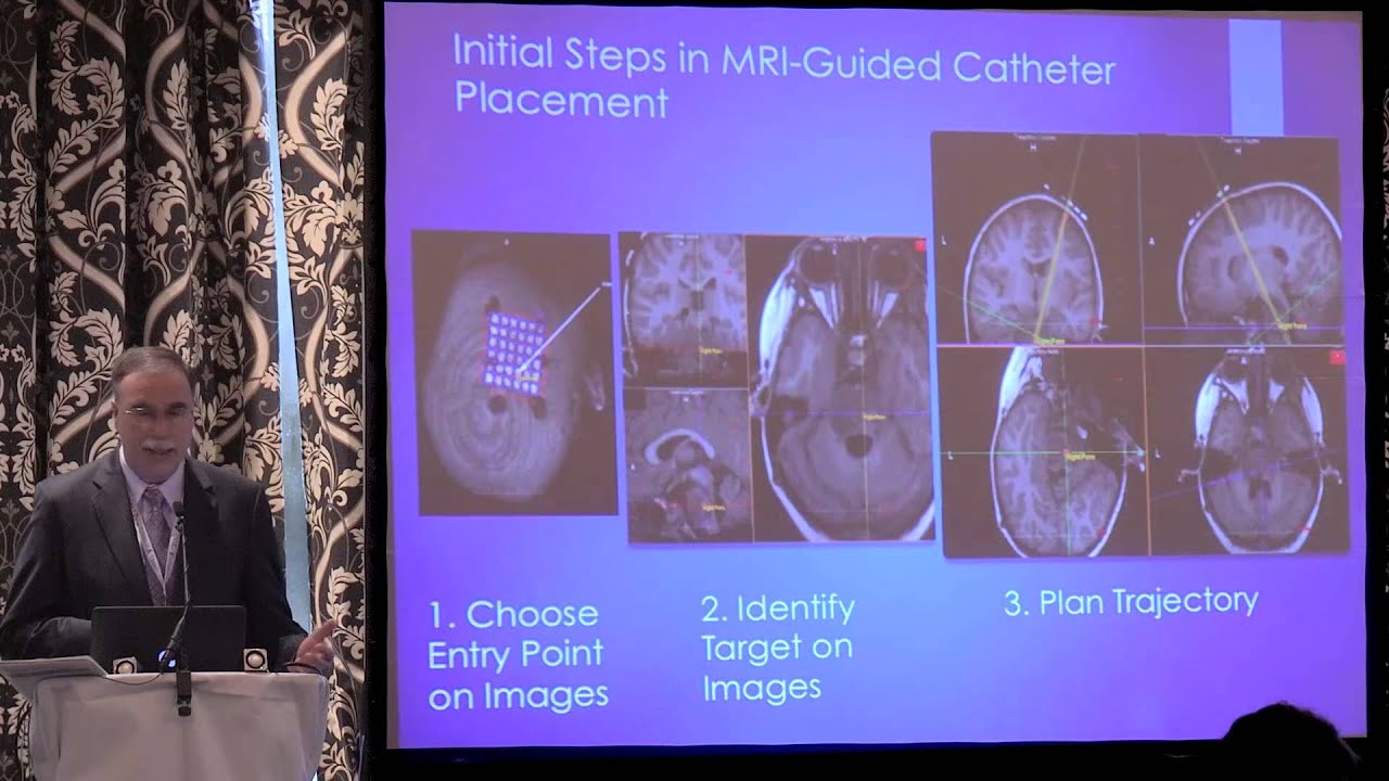Surgical Technique for AADC Gene Therapy. Prof John Heiss