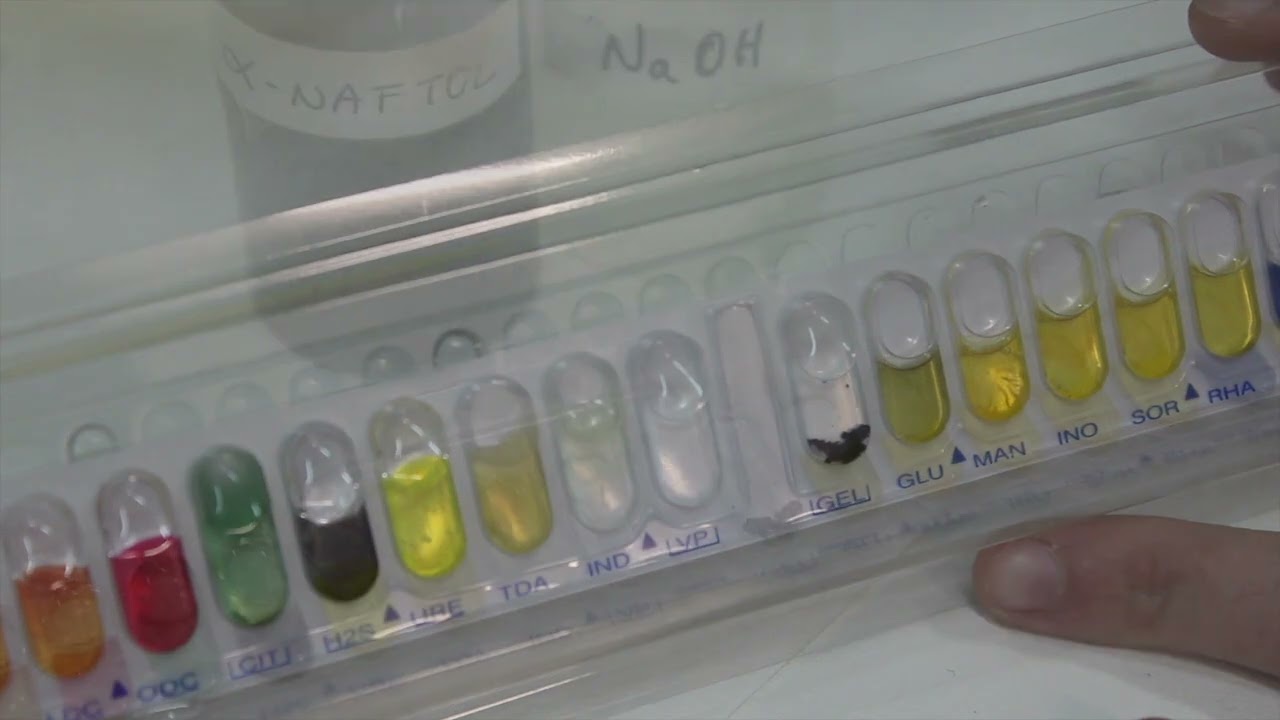 Identificación de enterobacterias mediante galerías API20E