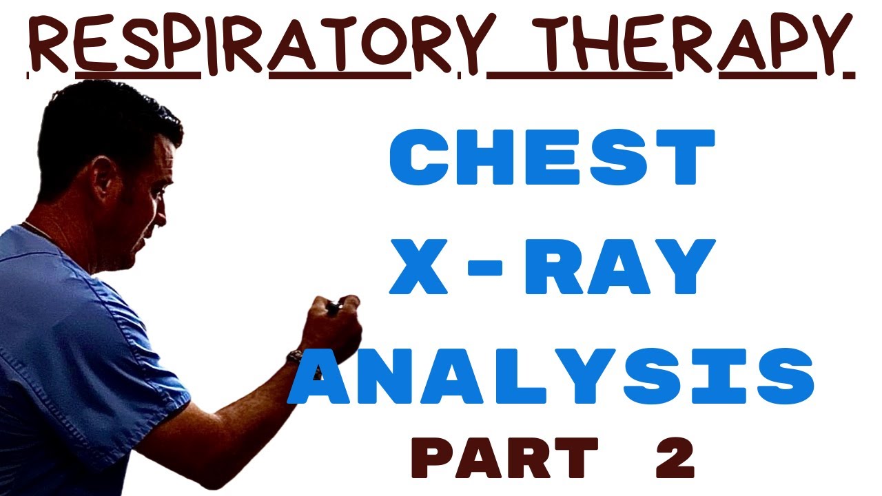 Respiratory Therapist - Chest Radiograph Interpretation Part 2 - Guess the CXR!