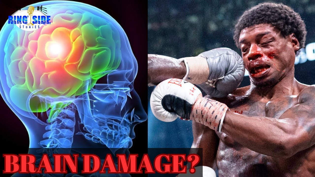 The SHOCKING TRUTH About Errol Spence Jr's Car Crash... Spence Brain Damage?