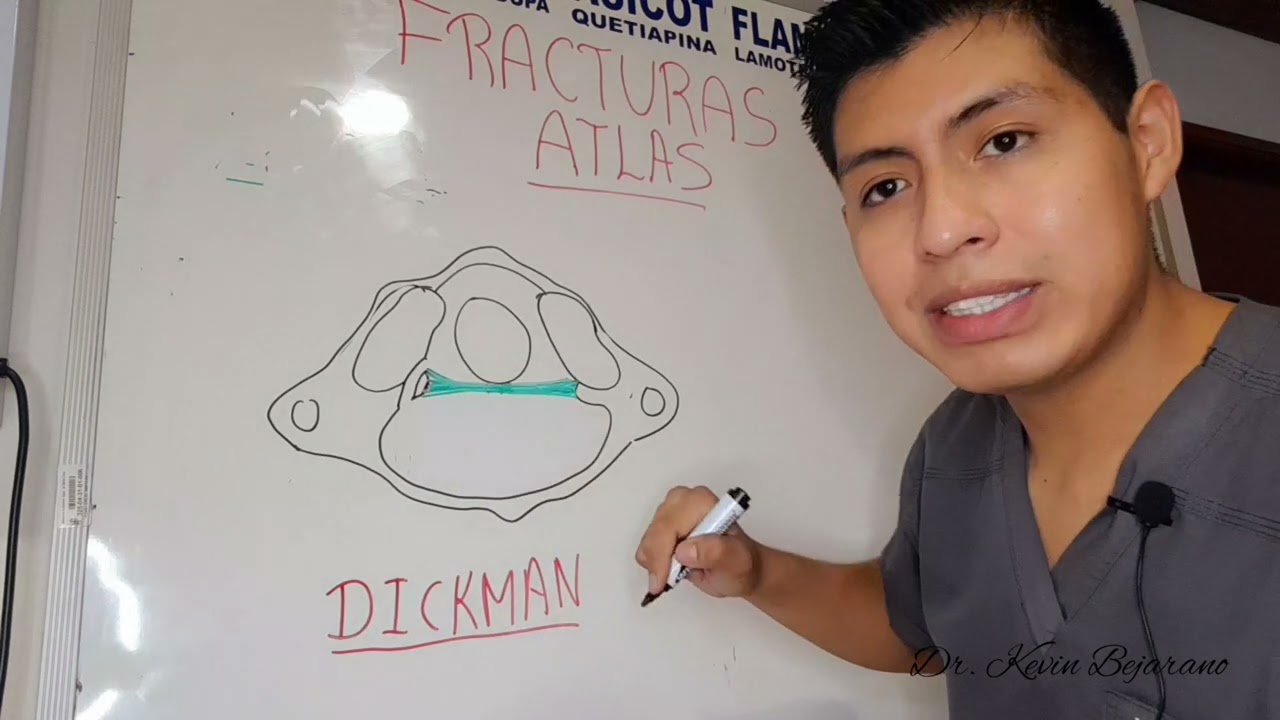 FRACTURAS DEL ATLAS. generalidades, clasificación de LANDELL y de DICKMAN, y enfoque al tratamiento