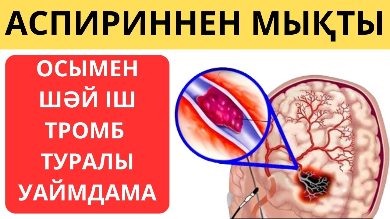 АСПИРИННЕН КАНДЫ ЖАҚСЫ СҰЙЫЛТАДЫ! Қан сұйылту жолдары. Бұл ТРОМБтарды тез ерітуге мүмкіндік береді!