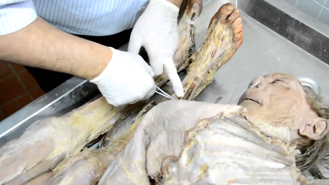 Anatomy.OSPE[Revision].IMS Block.Dr.A.Alshahat-By Silver-R