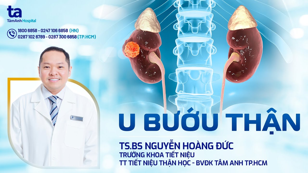 U bướu thận: Làm thế nào để nhận biết lành tính hay ác tính? | TS.BS Nguyễn Hoàng Đức | TNNH Tâm Anh