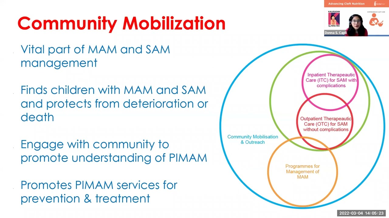 Acute Malnutrition in Children with Clefts- Day 2