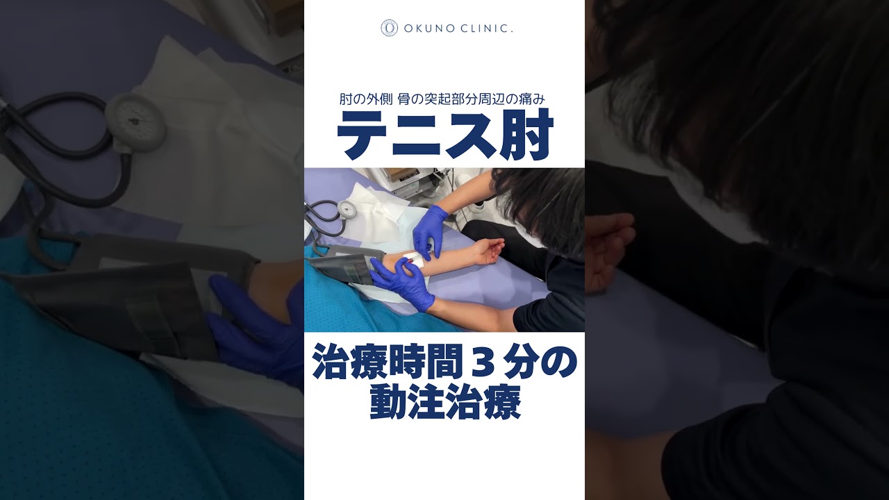テニス肘の新常識！&ldquo;モヤモヤ血管&rdquo;を治療する時代へ　  #オクノクリニック