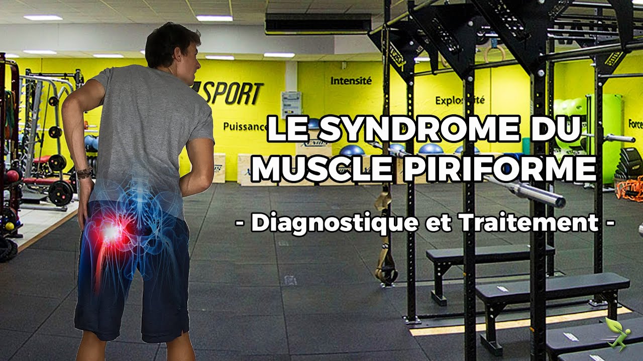 LE SYNDROME DU MUSCLE PIRIFORME (Diagnostic et Traitement)