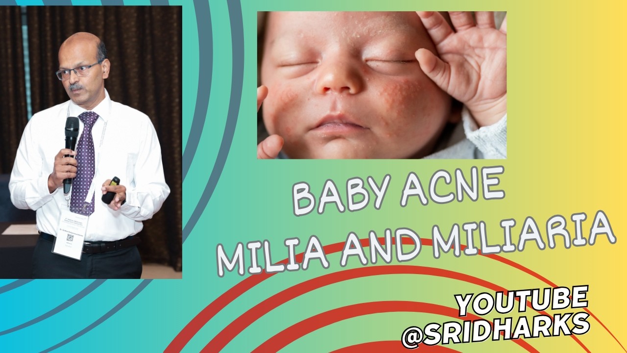 Детские угри, милиумы и потница