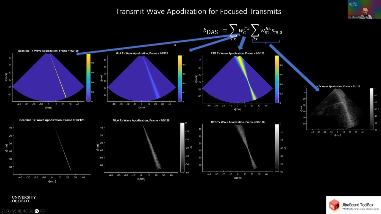 The Generalized Beamformer in the UltraSound ToolBox (IUS 2023)
