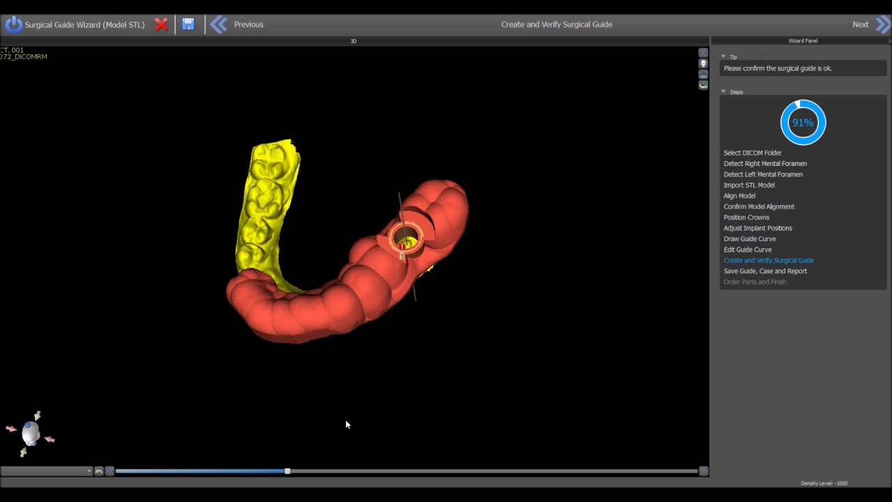 Guided Surgical Kits in Blue Sky Plan