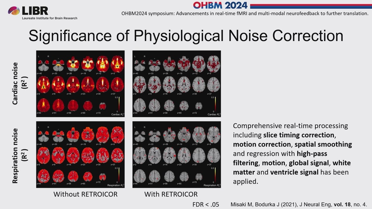 OHBM 2024 | Symposium | Masaya Misaki |  Unveiling the Mechanisms of Neurofeedback Training with P&hellip;