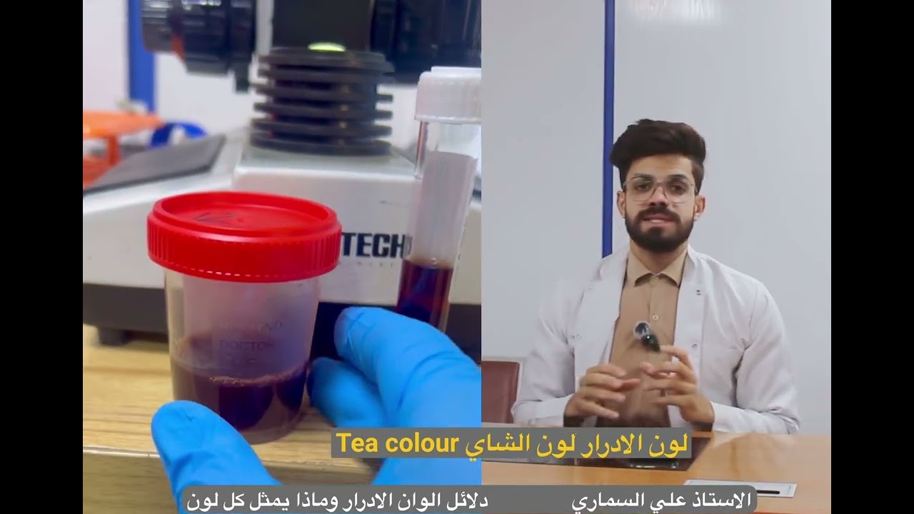 الوان عينات الادرار وكل لون ع شنو يدل ؟ الاستاذ علي السماري