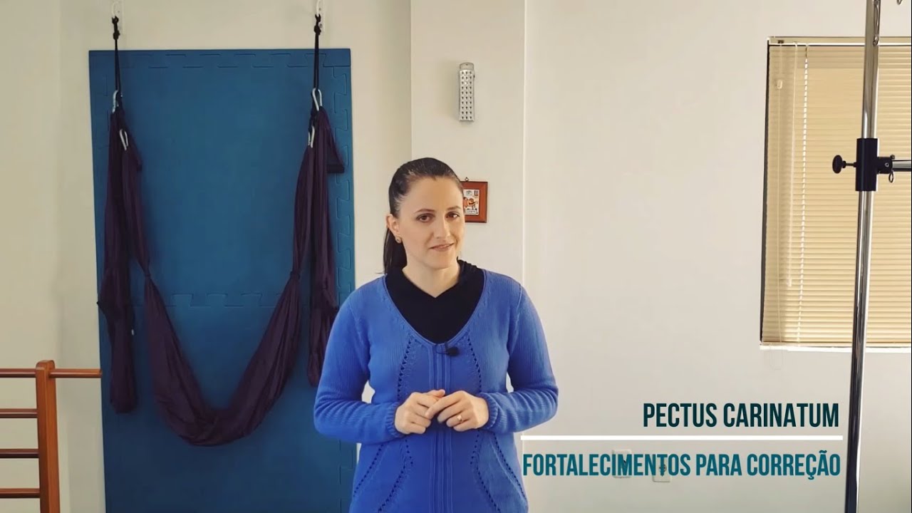 Pectus Carinatum Parte 2: Fortalecimentos e Exercícios Posturais
