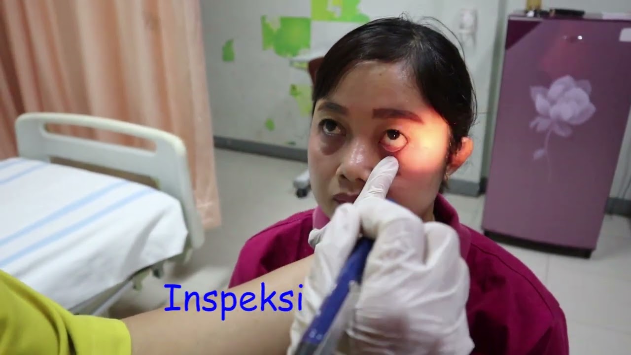 Pemeriksaan Fisik Sistem Endokrin