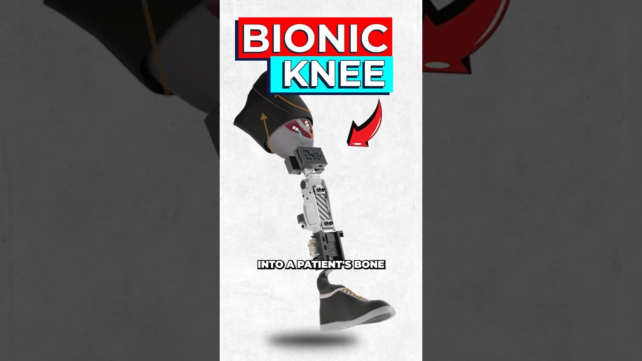 Naukowcy stworzyli realistyczne bioniczne kolano