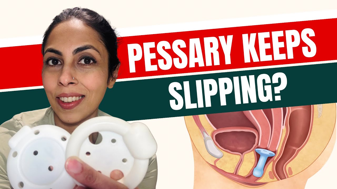 Pessary Problems Explained: Pain, Slipping, Discomfort