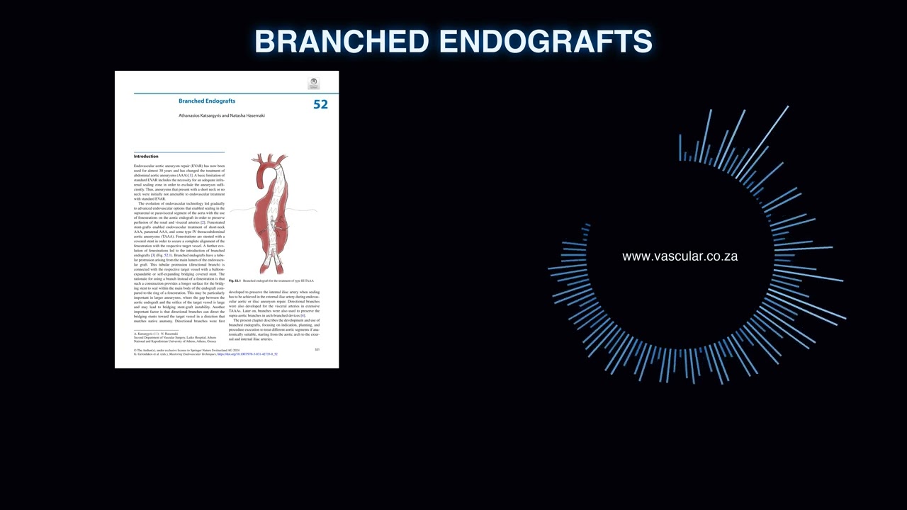 MET - 52 - Branched Endografts - Deep Dive Podcast