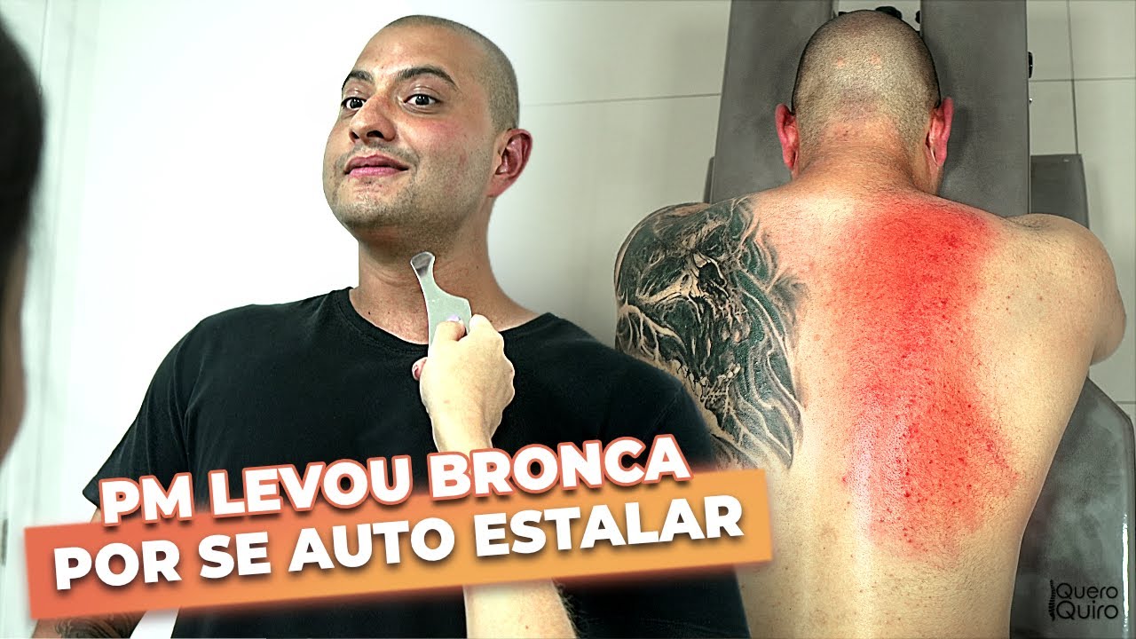 LIBERAÇÃO MIOFASCIAL EM POLICIAL MILITAR COM DOR CERVICAL