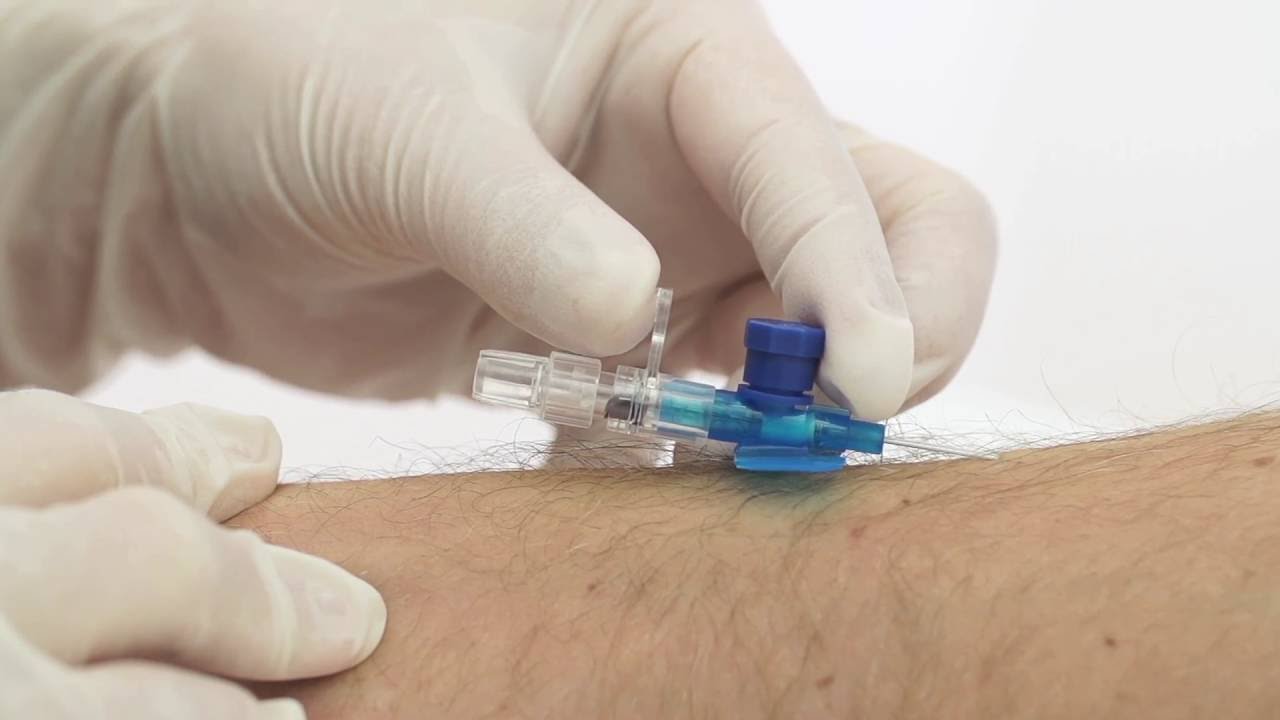 Anlæggelse af B Braun PVK Vasofix Safety