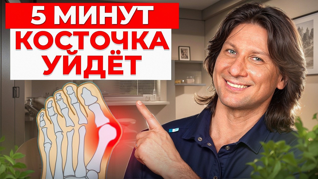 Шишка на большом пальце уйдет НАВСЕГДА! / Упражнения и рекомендации для устранения «косточки»