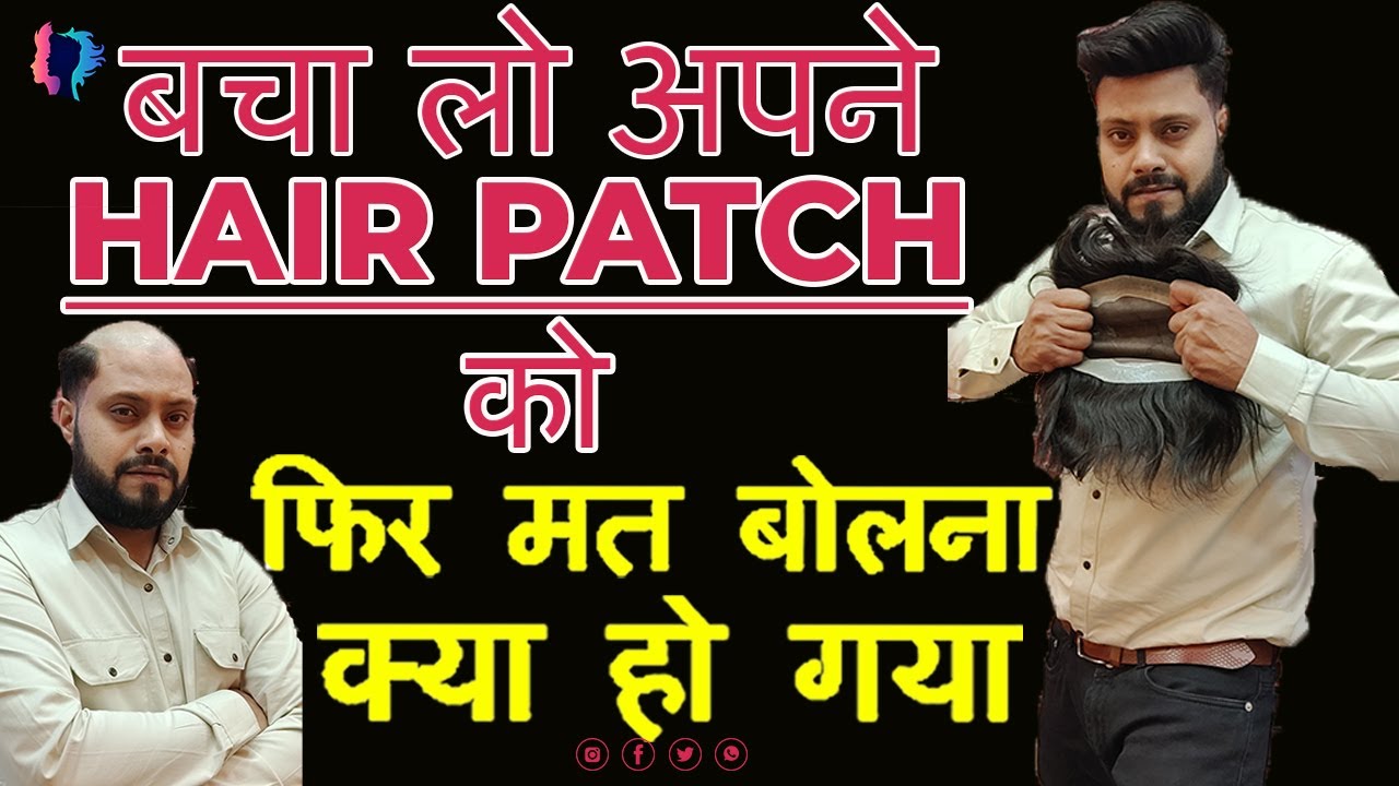 Hair Patch Life | All about Hair Patch Care | Non Surgical Hair Replacement