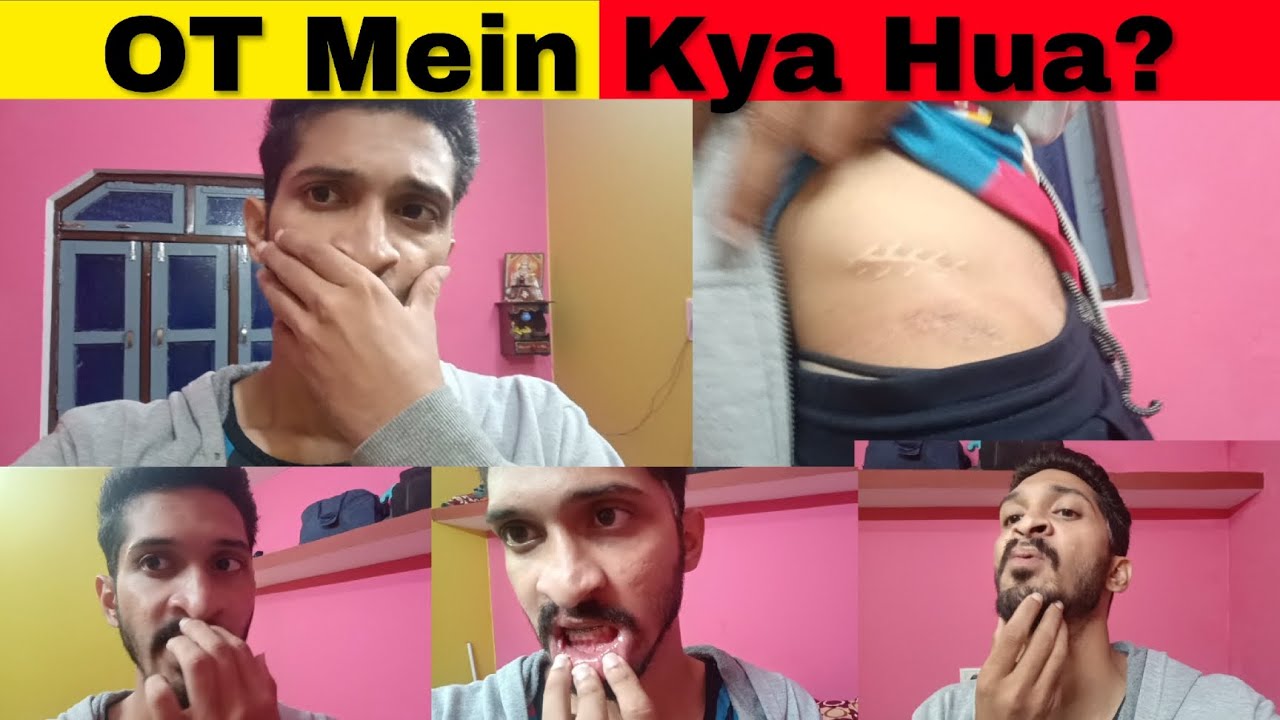 Operation Theatre Ke Andar: Mera Bi Jaw Surgery