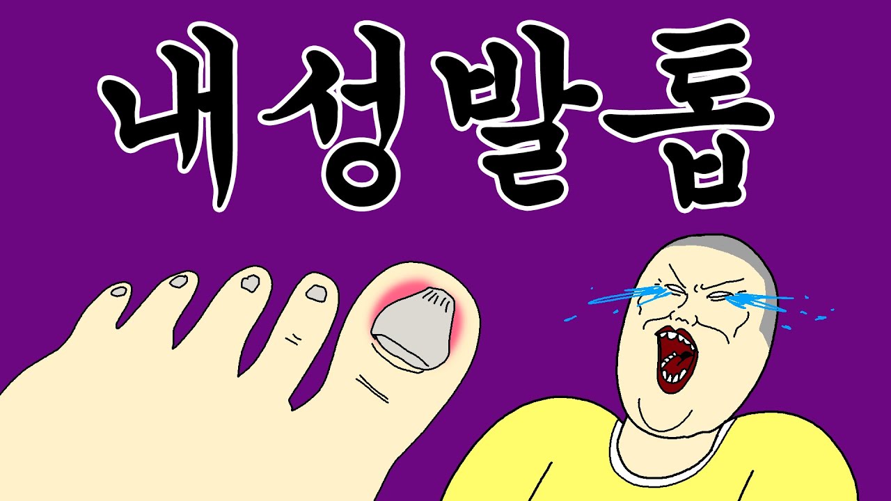 [짤툰 오리지널] 내성 발톱