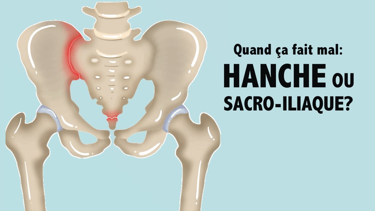 DOULEUR: ne confondez plus hanches et sacro iliaques !