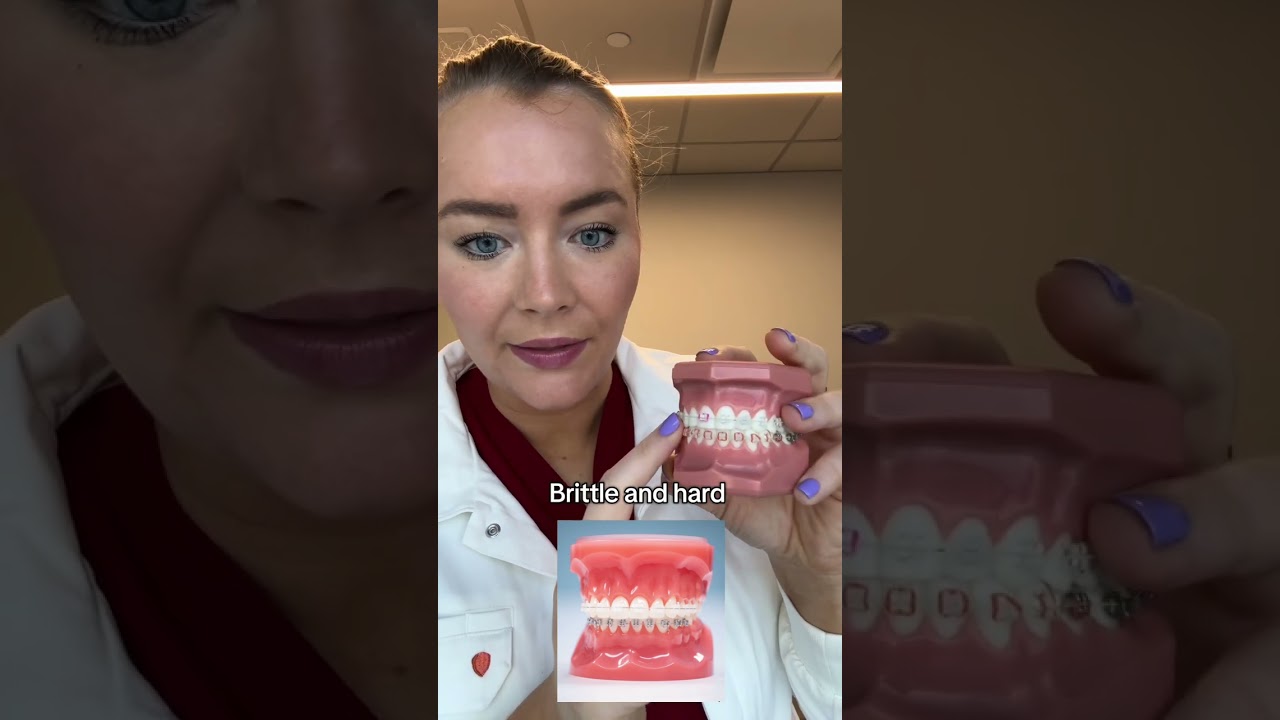 Ceramic brackets can chip your teeth! #braces #clearbraces #ceramicbraces