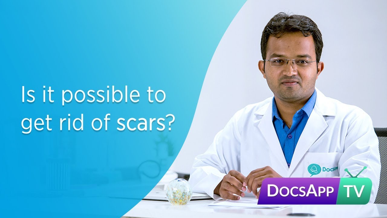 Is it possible to get Rid of Scars? Treatment for Scars #AsktheDoctor