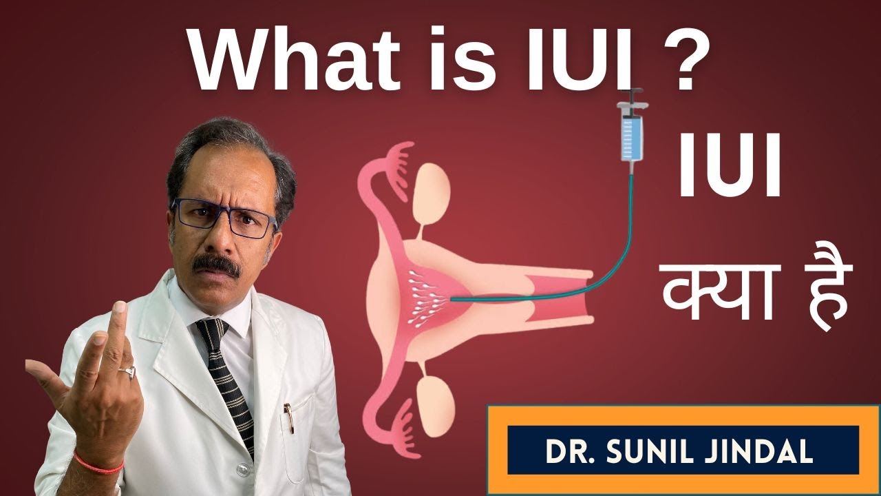 What is IUI|आईयूआई क्या है| Dr. Sunil Jindal|Jindal Hospital Meerut