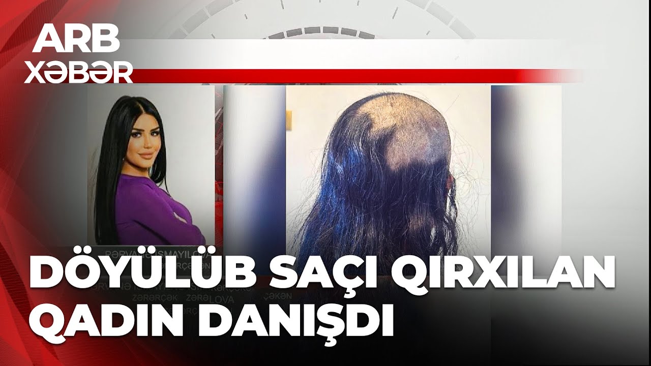 ARB XƏBƏR - Sa&ccedil;ı qırxılan qadının a&ccedil;ıqlaması - &ldquo;Qəfil gəlib divanda sa&ccedil;ımı kəsdi&rdquo;