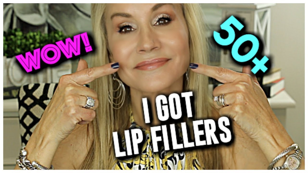MY NATURAL LOOKING LIP FILLERS | GO WITH ME AS I GET LIP INJECTIONS!!