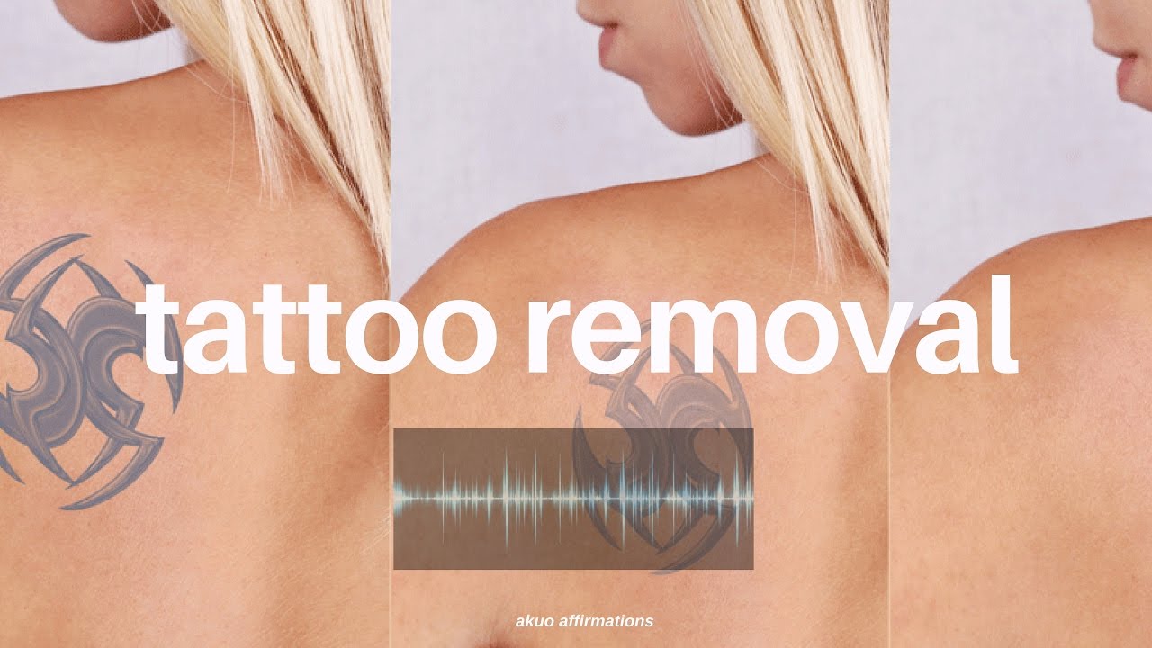 Powerful Tattoo Removal ―∎𝘢𝘶𝘥𝘪𝘰 𝘢𝘧𝘧𝘪𝘳𝘮𝘢𝘵𝘪𝘰𝘯𝘴 | Get Rid of Unwanted Tattoos