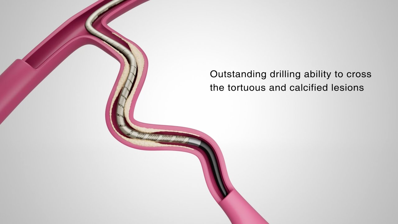 Elong&trade; Microcatheter - Smooth Navigation in Every Move
