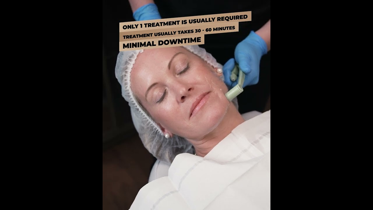 FaceTite Treatment Performed by Dr. Victoria Givens, with Amazing Before & After Photos