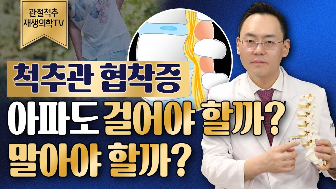 척추관협착증, 다리가 저리면 참고 걸어야할까? 척추 명의가 알려드립니다 @제애정형외과 (#척추관협착증 #척추협착증 #허리협착증 #척추명의 #간헐적파행 #척추병원)