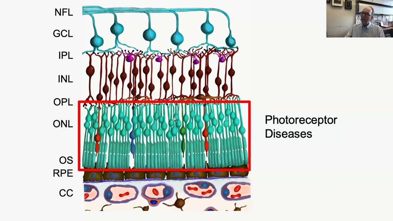 Lecture: Introduction to Inherited Retinal Disease