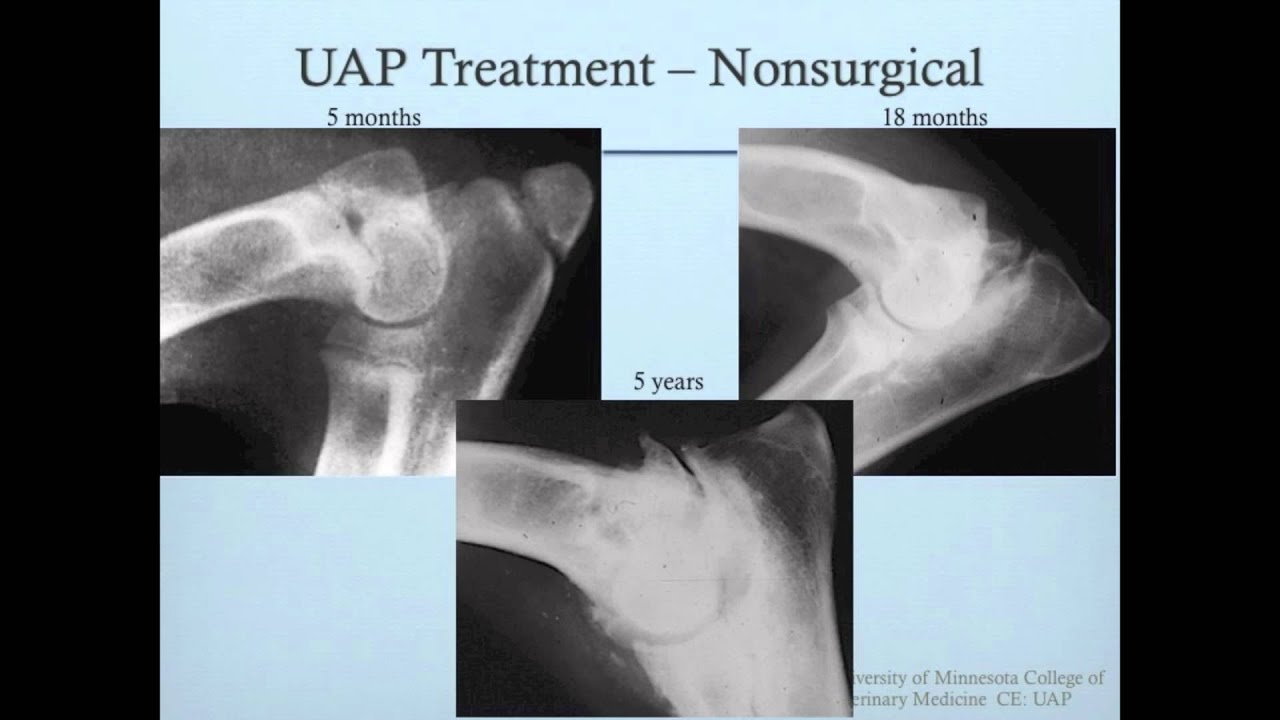 Ununited Anconeal Process UAP
