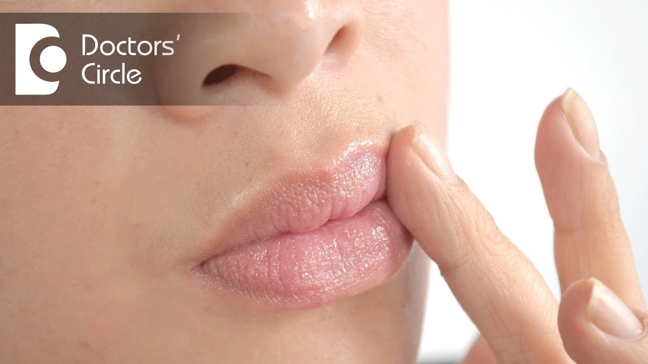 How to manage dryness & peeling of skin near nose & lips? - Dr. Satish Babu K