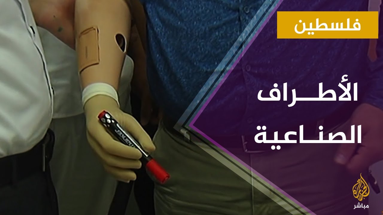 أمل جديد.. جولة في مستشفى حمد للأطراف الصناعية بغزة