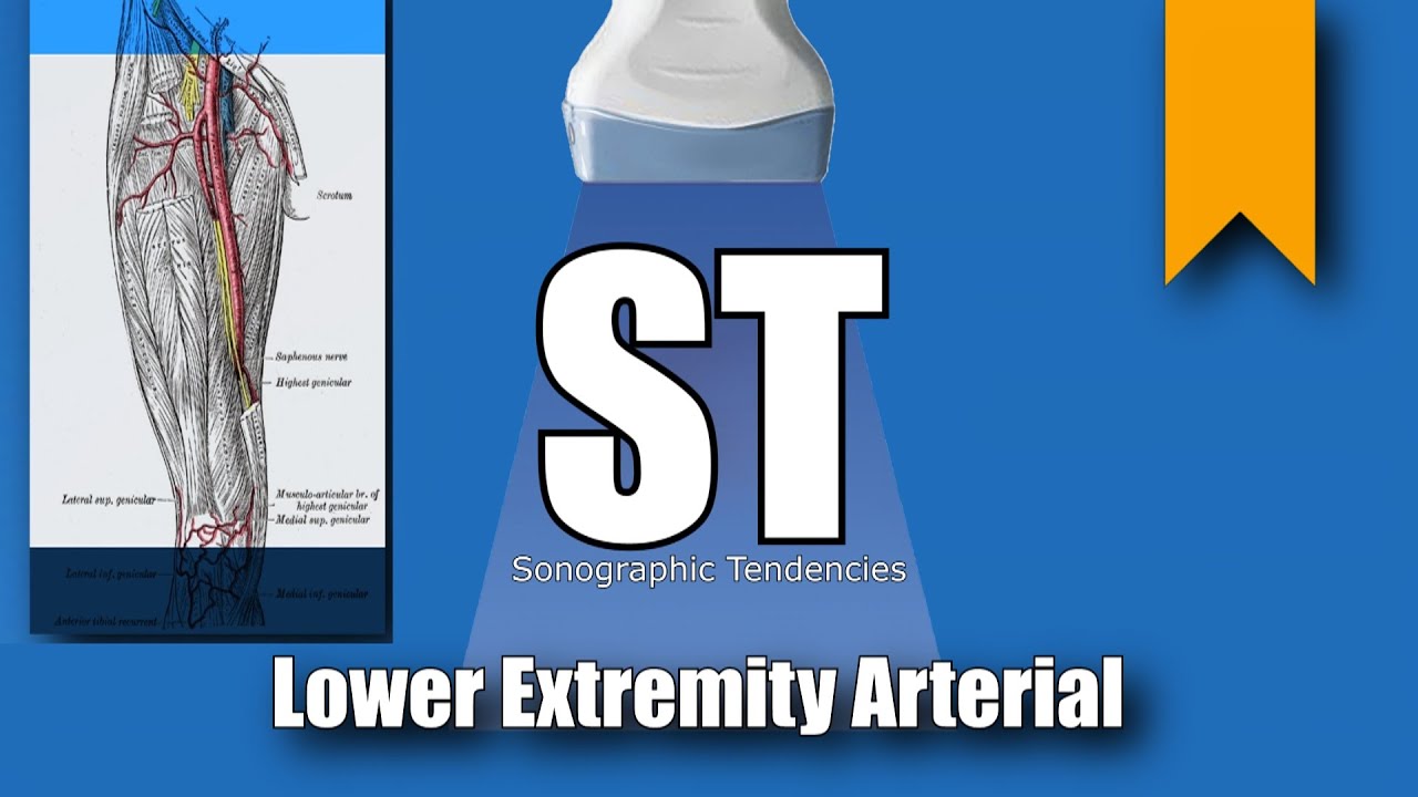 Lower Extremity Arterial Duplex Anatomy and Protocol