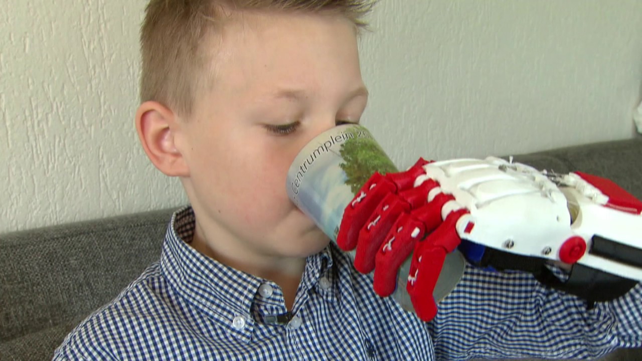 Guido (9) heeft een hand uit de 3D-printer